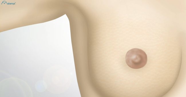 Seins-après-accouchement