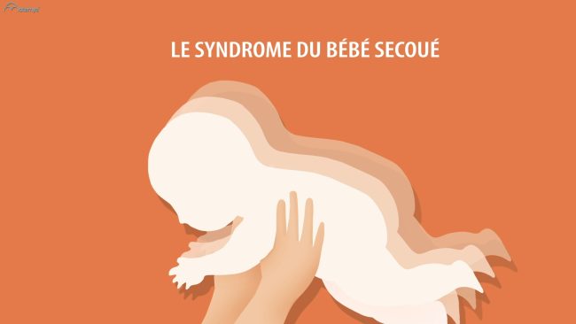 Syndrome-du-bébé-secoué